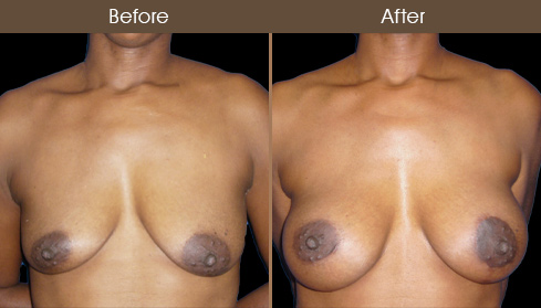 20202805155150_B81-Front